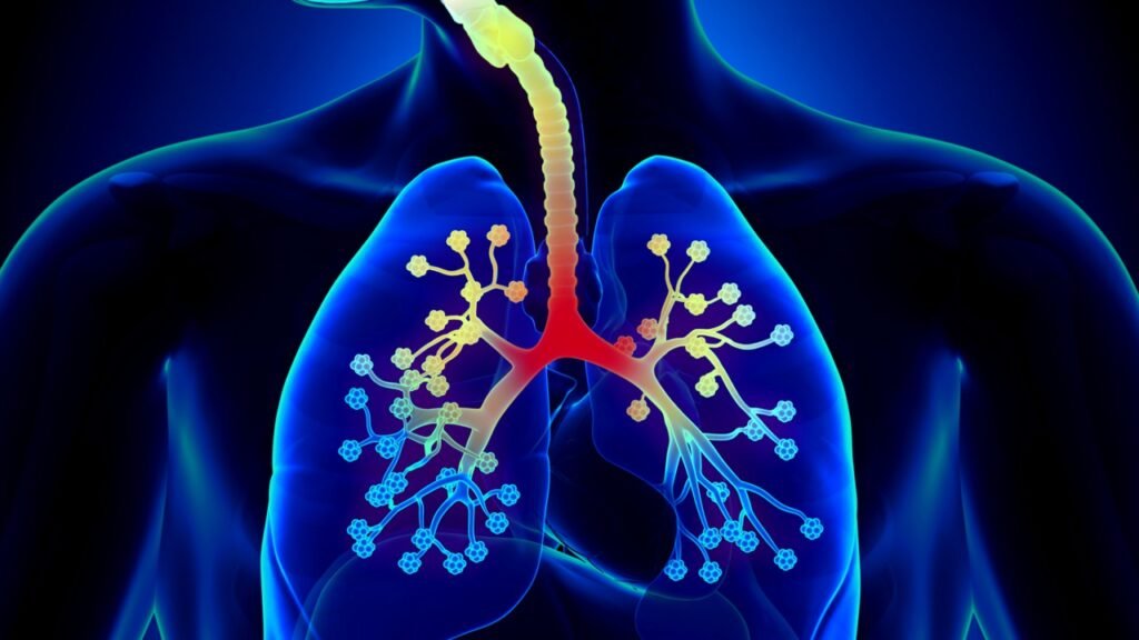 Bronchitis: Symptoms, Causes, and Effective Treatment Options